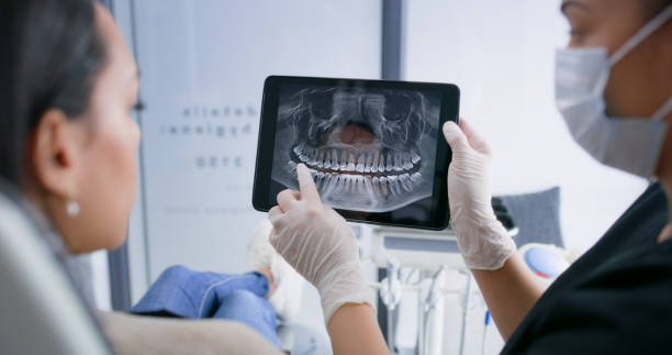 Licensed Tooth Extraction service in Livingston, TX - Smile Center Dentistry